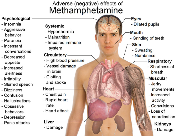 Gesundheitsbeeinträchtigungen durch Metamphetamin